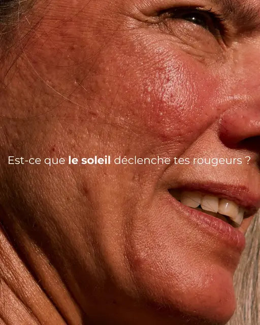 Rosyra Sérum Anti-Taches